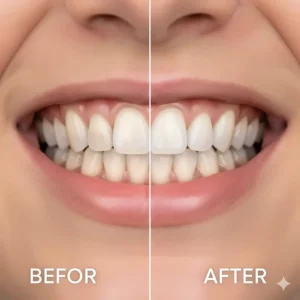 Comparison of teeth before and after using a toothpaste specifically formulated for coffee drinkers.