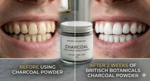 A before and after comparison showing a brighter, whiter smile after two weeks of using charcoal teeth whitening powder.