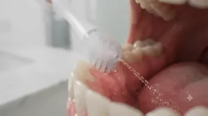 Step-by-step guide demonstrating the correct 45-degree angle for using a gum massager on sensitive gums.